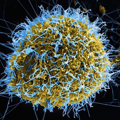 Micrograph of Ebola