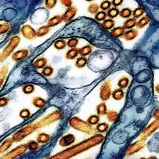 Micrograph of Bird Flu